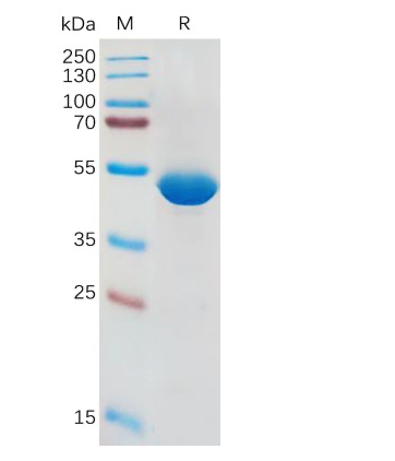 Recombinant human IL1B protein with C-terminal human Fc tag